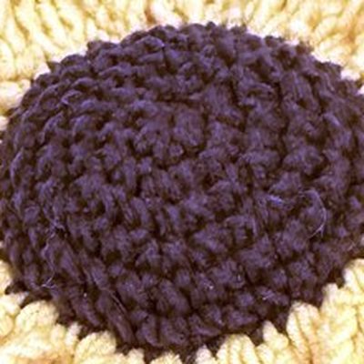 Close-up of the stitches, cropped from the same photo